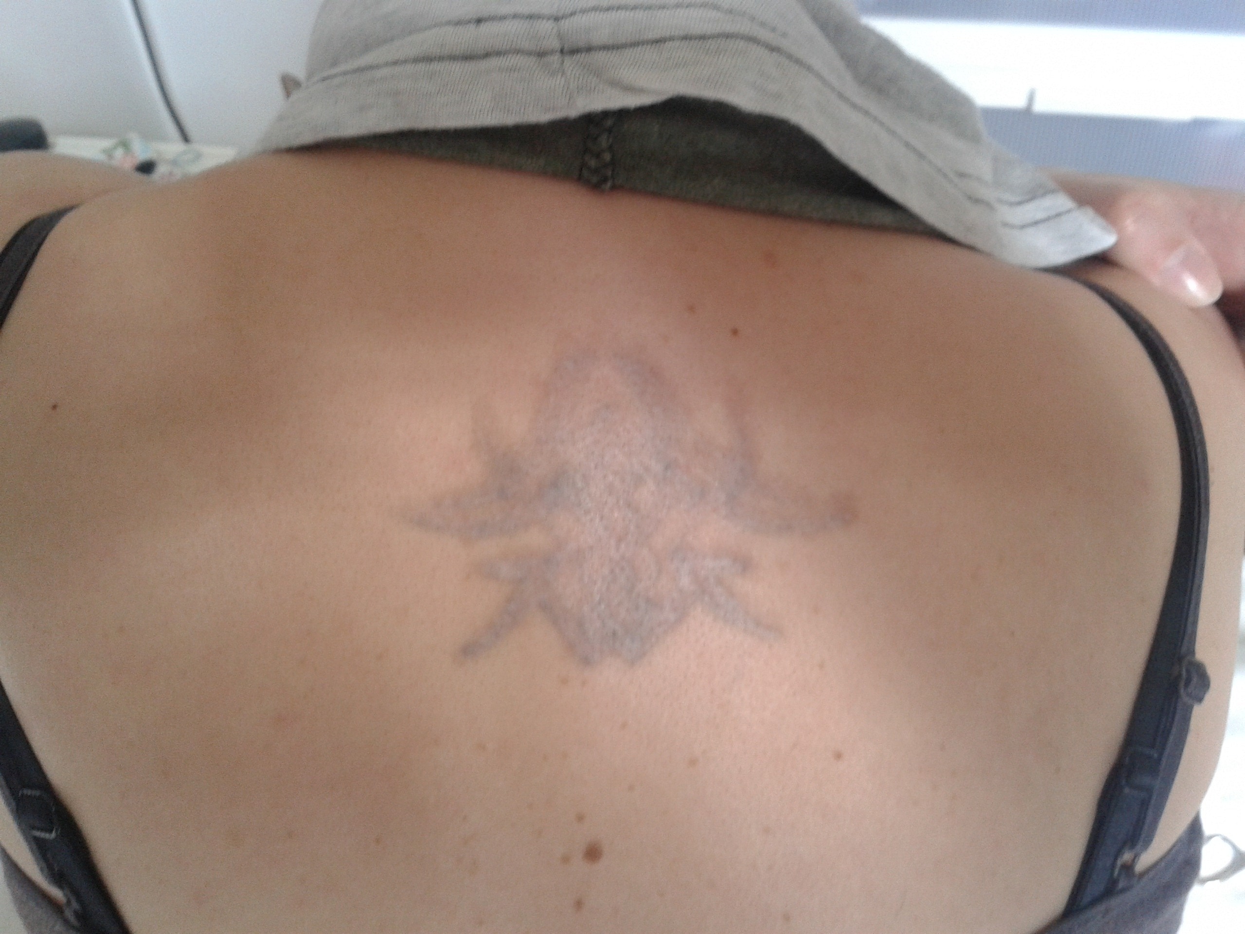 funnycat: Cover-Up für gelasertes Tattoo